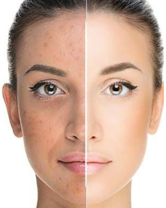 Before and after comparison of a woman's face with makeup application.