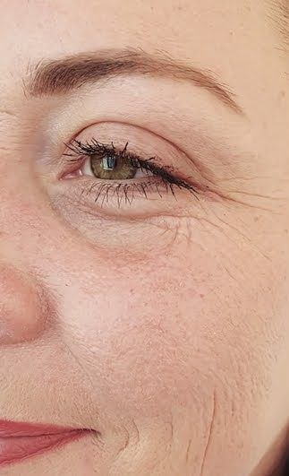 Collagen and Your Skin: The Protein Behind Firm, Youthful-Looking Skin