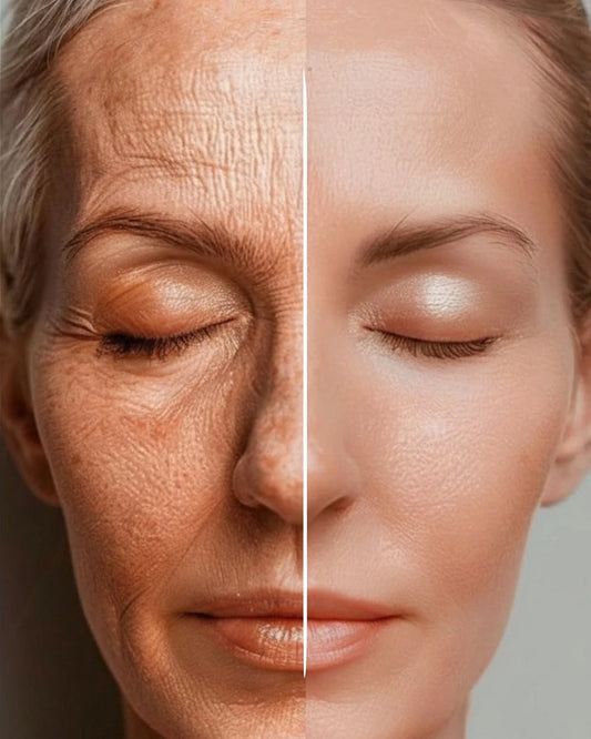 Before and after comparison of a woman's face with visible aging signs on the left and smoother skin on the right.